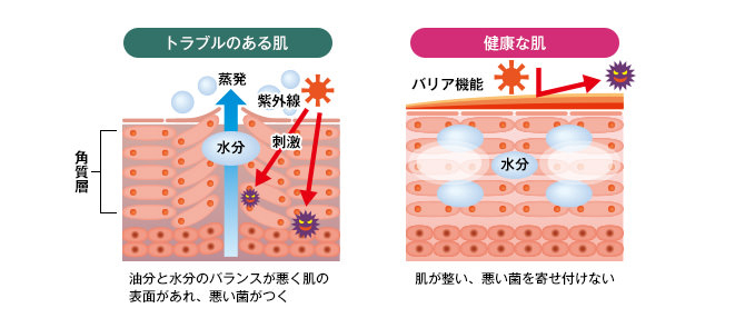 クリスタルモーション　ニキビ